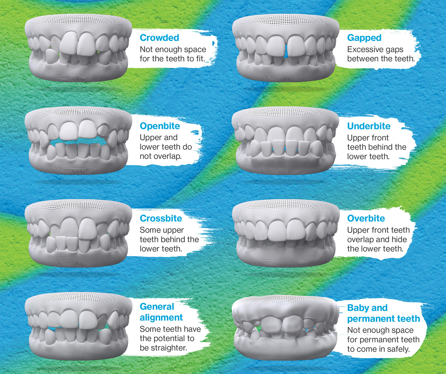 New Patients Welcome - Denali Dental  - Dentist Milton New Patients Welcome - Denali Dental  - Dentist Milton